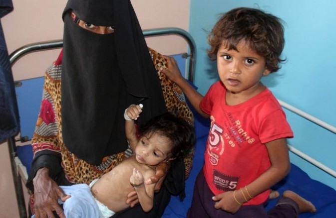 اليونيسف: أكثر من 16 مليون طفل في الشرق الأوسط وشمال إفريقيا يعانون من سوء التغذية